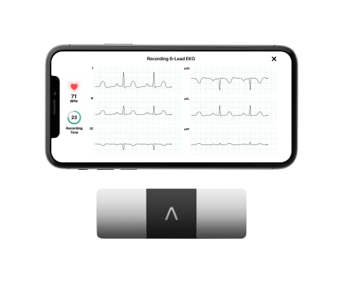 AliveCor KardiaMobile 6L - Dispositivo ECG portátil de 6 Derivaciones, compatible con smartphones y tablets a través de Bluetooth